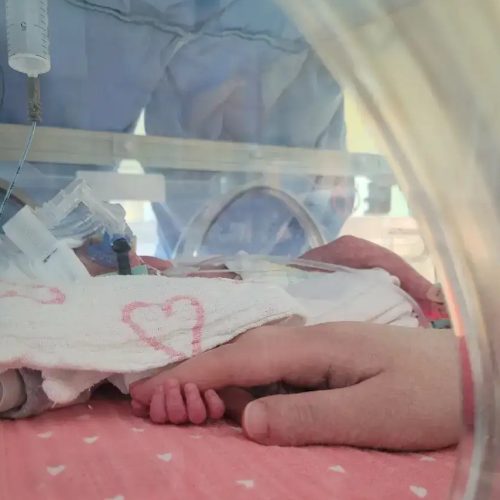 Rodząc w 24 tygodniu ciąży